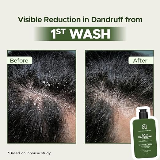 Mens Shampoo